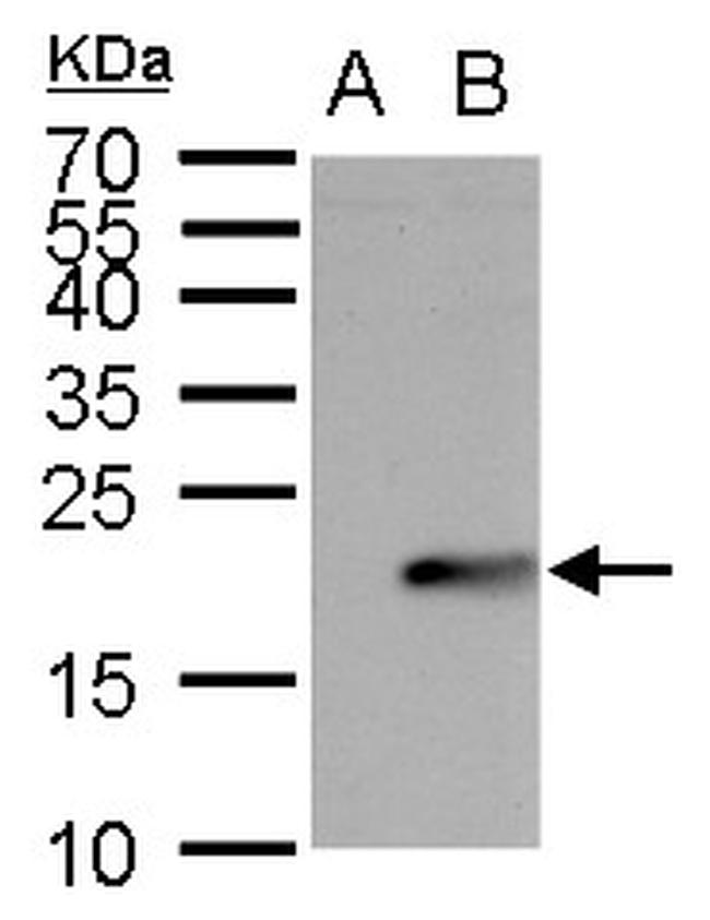 UBE2B Antibody in Western Blot (WB)