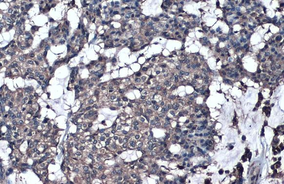 GGT1 Antibody in Immunohistochemistry (Paraffin) (IHC (P))