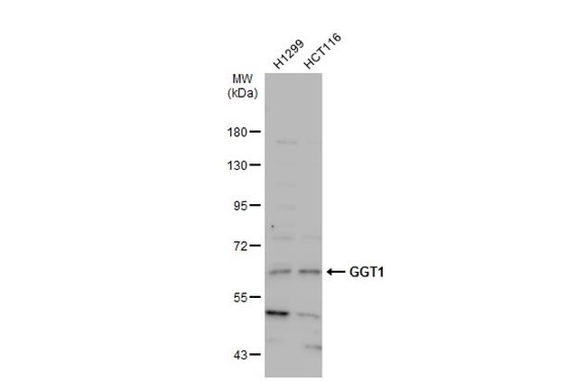 GGT1 Antibody in Western Blot (WB)