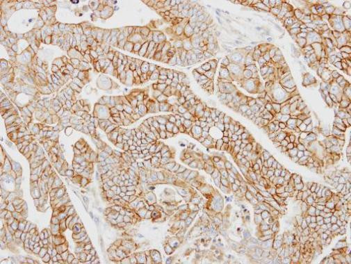 AP2M1 Antibody in Immunohistochemistry (Paraffin) (IHC (P))