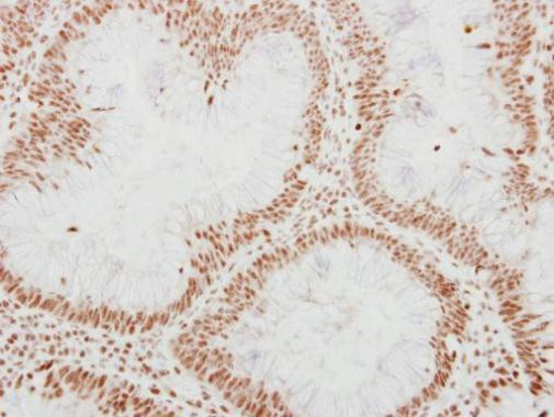 ADAR1 Antibody in Immunohistochemistry (Paraffin) (IHC (P))