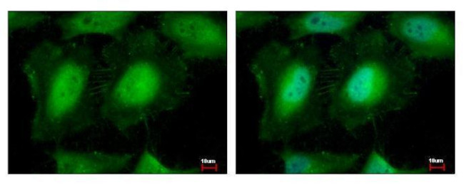 eIF3k Antibody in Immunocytochemistry (ICC/IF)