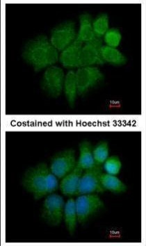 Cytokeratin 2e Antibody in Immunocytochemistry (ICC/IF)