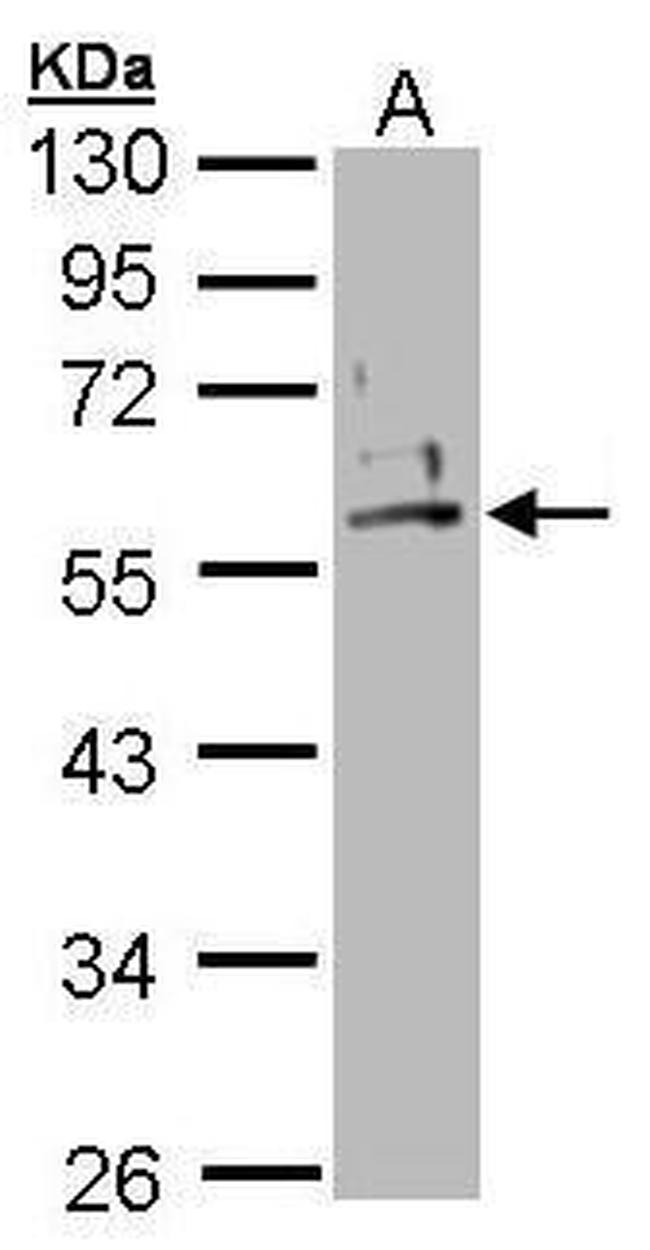 Cytokeratin 2e Antibody in Western Blot (WB)