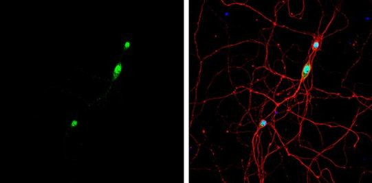 NOVA1 Antibody in Immunocytochemistry (ICC/IF)