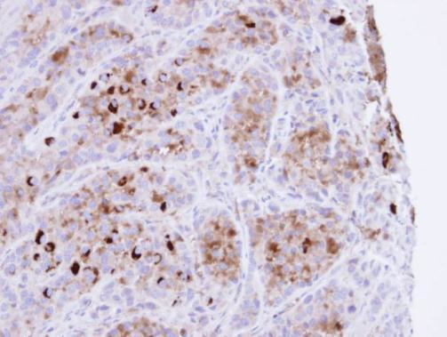 CRHSP-24 Antibody in Immunohistochemistry (Paraffin) (IHC (P))