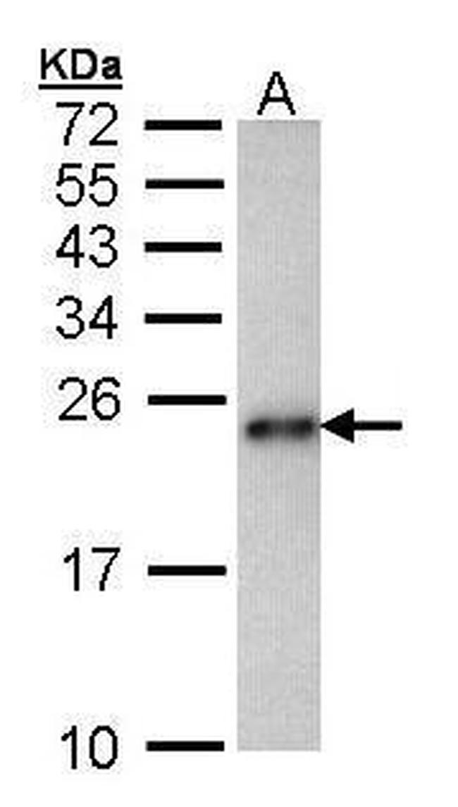 CRHSP-24 Antibody in Western Blot (WB)