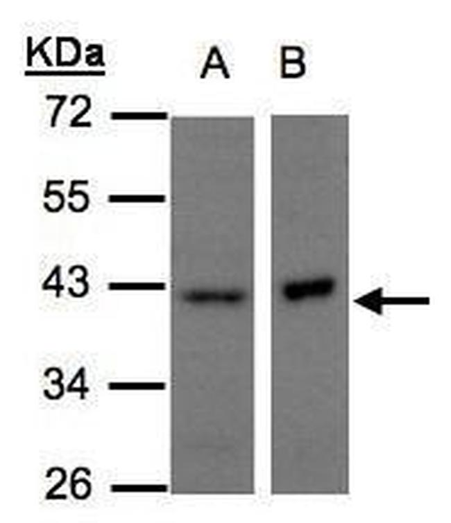 NDUFA10 Antibody in Western Blot (WB)
