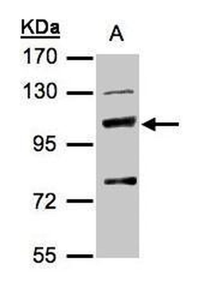 MANBA Antibody in Western Blot (WB)