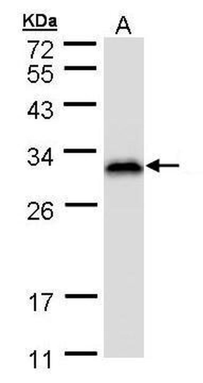 RANBP1 Antibody in Western Blot (WB)