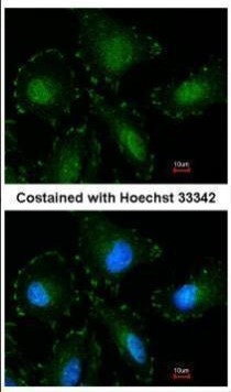 Calpain 5 Antibody in Immunocytochemistry (ICC/IF)