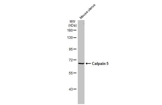 Calpain 5 Antibody in Western Blot (WB)