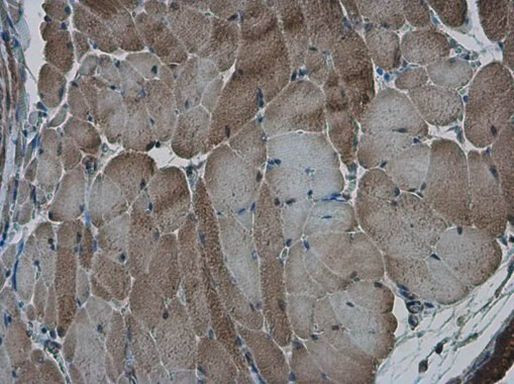 AMPK alpha-2 Antibody in Immunohistochemistry (Paraffin) (IHC (P))