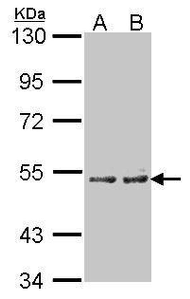 CYP4A11 Antibody in Western Blot (WB)