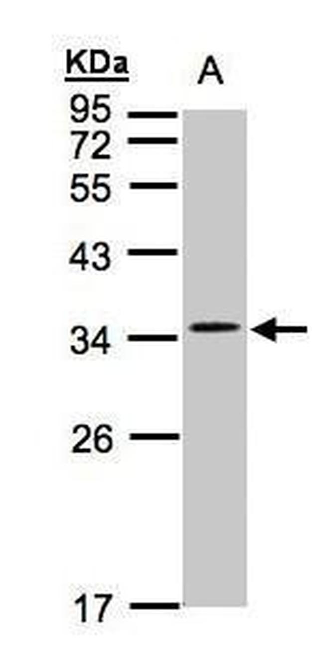 CACNG5 Isoform B Antibody in Western Blot (WB)