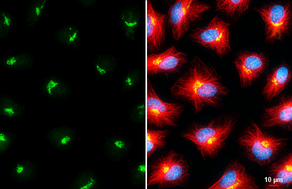 GALNT2 Antibody in Immunocytochemistry (ICC/IF)