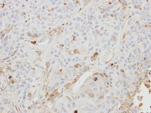 BHMT2 Antibody in Immunohistochemistry (Paraffin) (IHC (P))