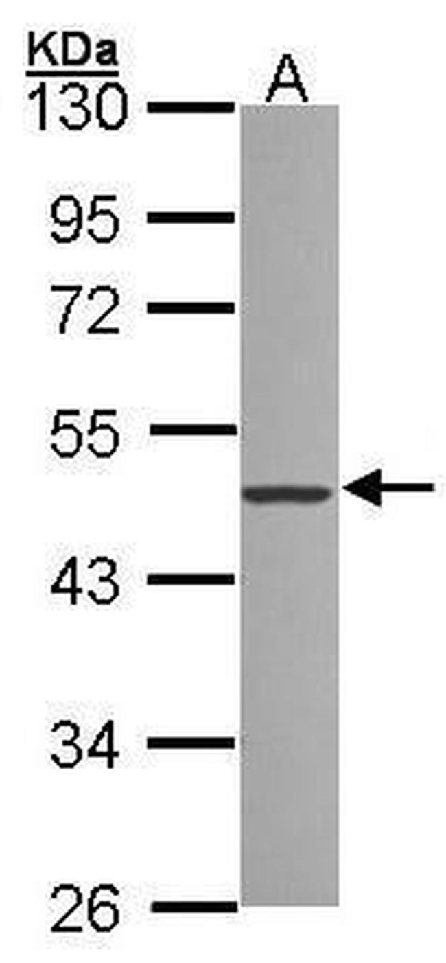 ZNF277 Antibody in Western Blot (WB)