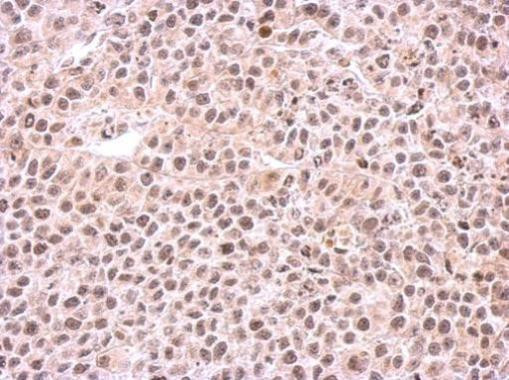 PSMC6 Antibody in Immunohistochemistry (Paraffin) (IHC (P))