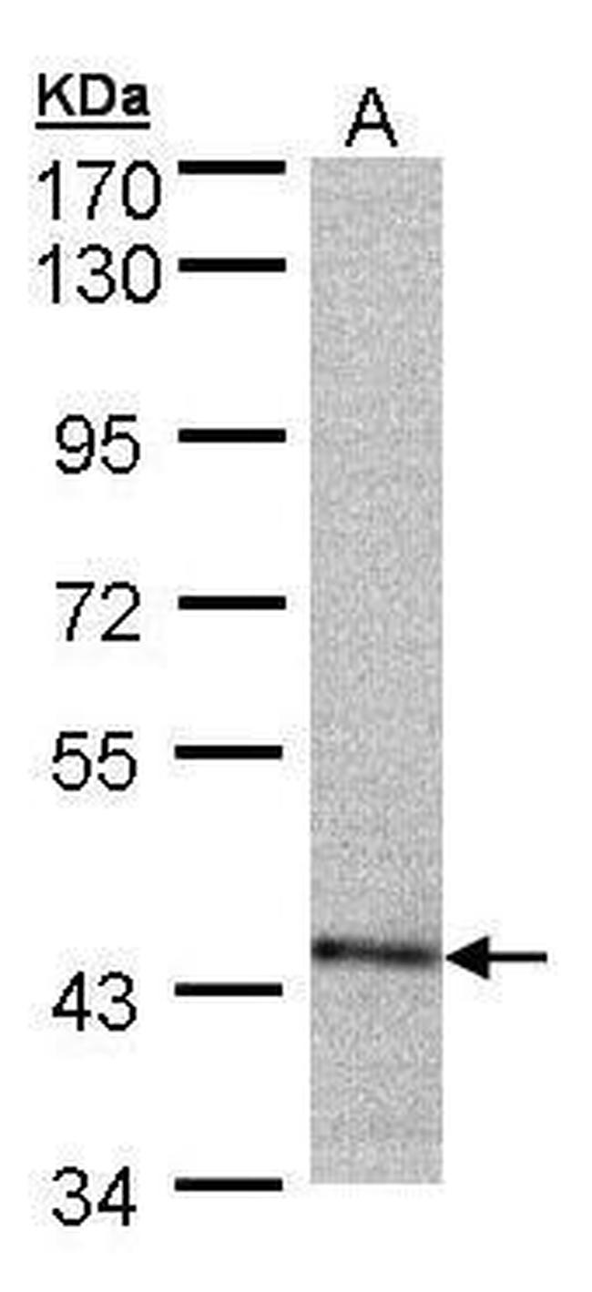 PSMC6 Antibody in Western Blot (WB)