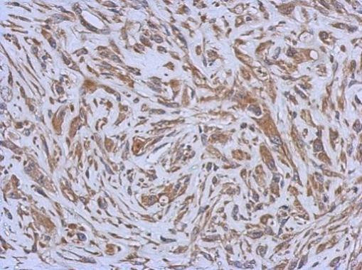 ENTPD3 Antibody in Immunohistochemistry (Paraffin) (IHC (P))