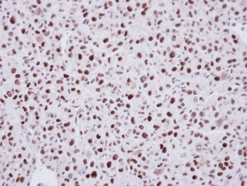 LDB1 Antibody in Immunohistochemistry (Paraffin) (IHC (P))