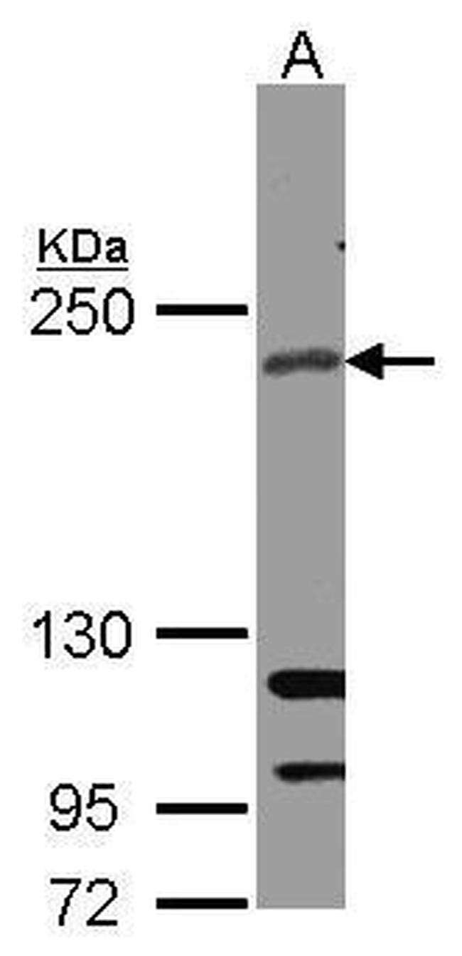 RICTOR Antibody in Western Blot (WB)