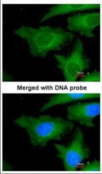 UBE2L3 Antibody in Immunocytochemistry (ICC/IF)