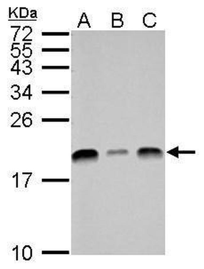 UBE2L3 Antibody in Western Blot (WB)