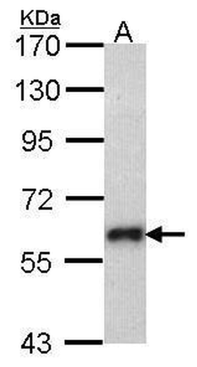 SOCS5 Antibody in Western Blot (WB)