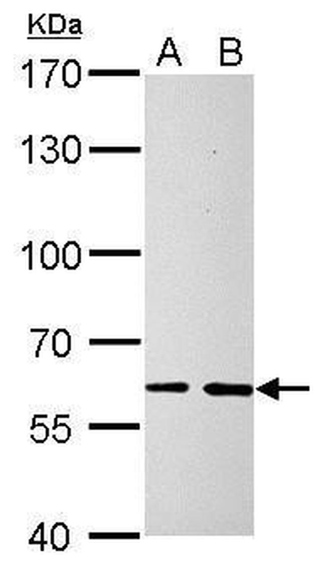 SOCS5 Antibody in Western Blot (WB)