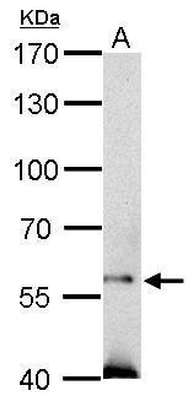 SOCS5 Antibody in Western Blot (WB)