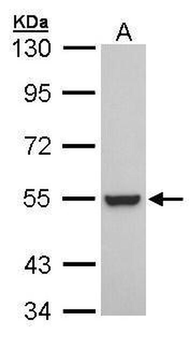 RXRB Antibody in Western Blot (WB)