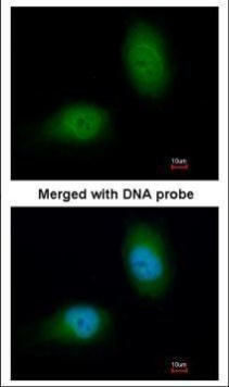 HSPB8 Antibody in Immunocytochemistry (ICC/IF)