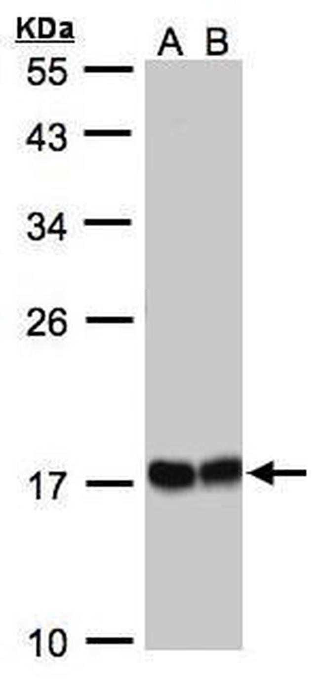 HSPB8 Antibody in Western Blot (WB)