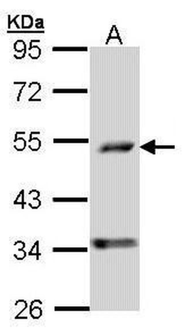 PDSS2 Antibody in Western Blot (WB)