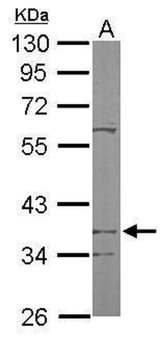 PDSS2 Antibody in Western Blot (WB)