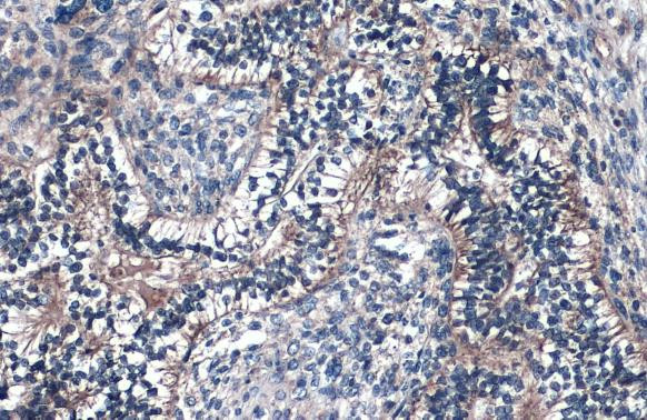 Fibulin 2 Antibody in Immunohistochemistry (Paraffin) (IHC (P))