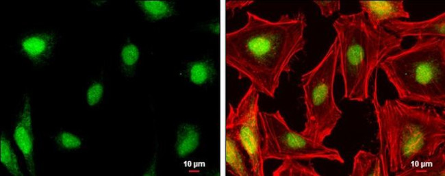 NR0B1 Antibody in Immunocytochemistry (ICC/IF)