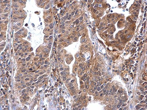 Annexin A7 Antibody in Immunohistochemistry (Paraffin) (IHC (P))