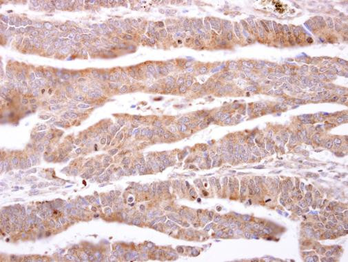 FABP6 Antibody in Immunohistochemistry (Paraffin) (IHC (P))