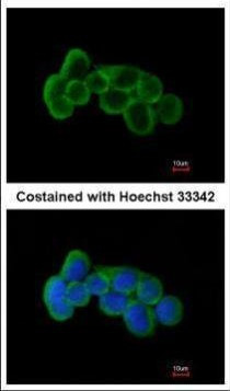 FLRT1 Antibody in Immunocytochemistry (ICC/IF)