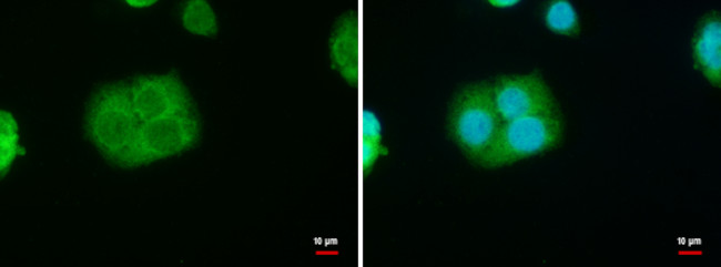 STAR Antibody in Immunocytochemistry (ICC/IF)