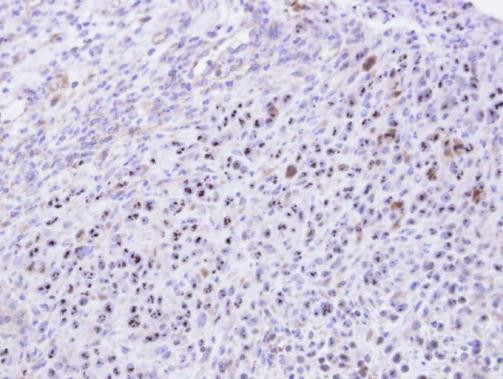 KRR1 Antibody in Immunohistochemistry (Paraffin) (IHC (P))