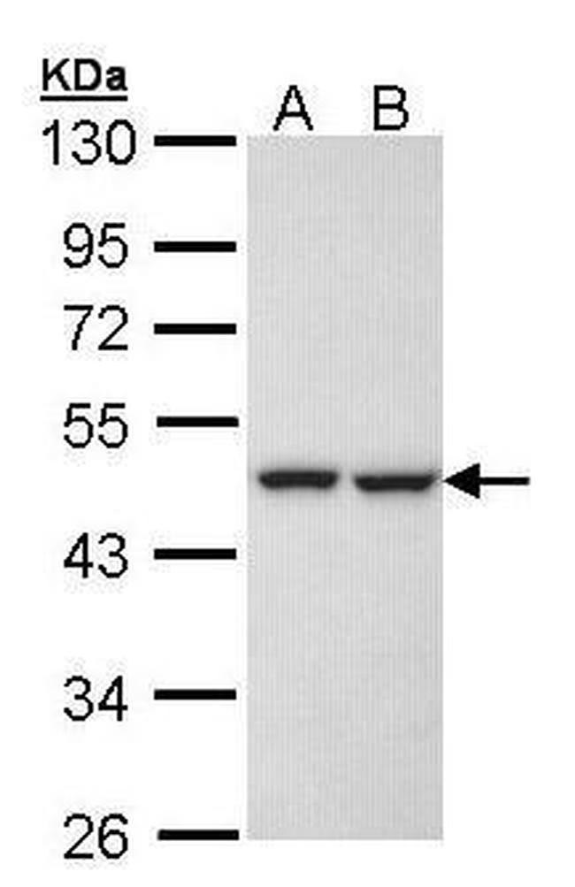 KRR1 Antibody in Western Blot (WB)