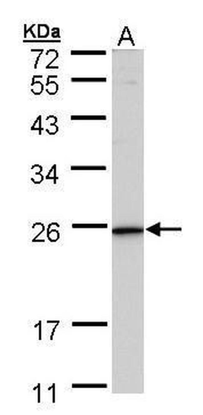 KLRG1 Antibody in Western Blot (WB)