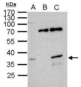 WBSCR22 Antibody in Immunoprecipitation (IP)