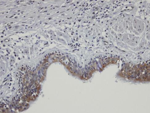 SHKBP1 Antibody in Immunohistochemistry (Paraffin) (IHC (P))