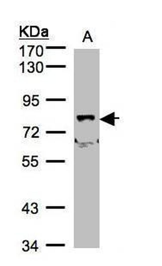 SHKBP1 Antibody in Western Blot (WB)