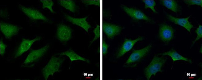 TRIM37 Antibody in Immunocytochemistry (ICC/IF)